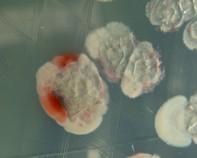 streptomyces colonies streptomyces colonies